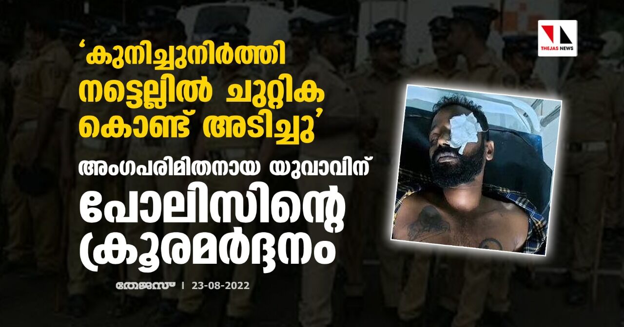 കുനിച്ചുനിര്‍ത്തി നട്ടെല്ലില്‍ ചുറ്റിക കൊണ്ട് അടിച്ചു; അം​ഗപരിമിതനായ യുവാവിന് പോലിസിന്റെ ക്രൂരമര്‍ദ്ദനം